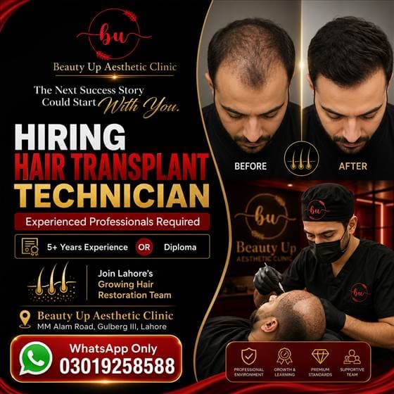Beauty Up Hair Transplant Technician Ad